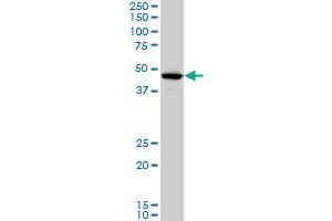 LHX5 monoclonal antibody (M05), clone 2B11. (LHX5 Antikörper  (AA 136-235))
