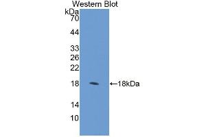 Figure. (RCBTB2 Antikörper  (AA 394-519))