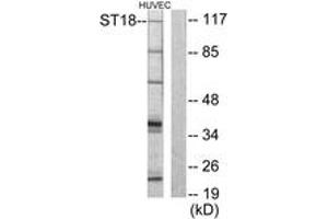 Western blot analysis of extracts from HuvEc cells, using ZNF387 Antibody.