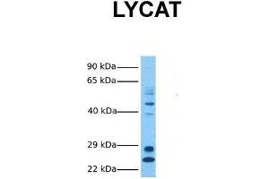 Host:  Rabbit  Target Name:  LYCAT  Sample Tissue:  Human Fetal Liver  Antibody Dilution:  1. (LCLAT1 Antikörper  (Middle Region))