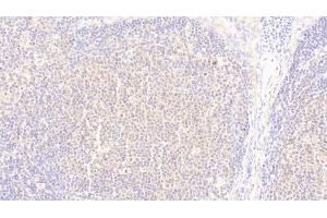 Immunohistochemistry (IHC) image for anti-Ubiquitin Associated Protein 2 (UBAP2) (AA 1-104) antibody (ABIN7435808)