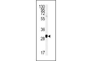 SC31B Antibody (C-term) (ABIN651805 and ABIN2840406) western blot analysis in NCI- cell line lysates (15 μg/lane). (SEC31B Antikörper  (C-Term))