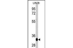 Western blot analysis of LIN28 recombinant protein by anti-LIN28A Monoclonal Antibody (ABIN387790 and ABIN2838026). (LIN28A Antikörper)