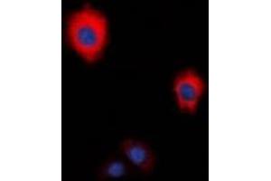 Immunofluorescent analysis of ZAP70 staining in HeLa cells. (ZAP70 Antikörper  (C-Term))
