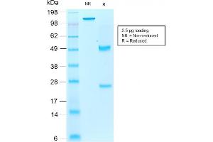 SDS-PAGE Analysis Purified AIF1 / Iba1 Mouse Recombinant Monoclonal Antibody (rAIF1/1909). (Rekombinanter Iba1 Antikörper  (AA 1-146))