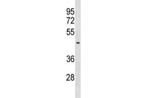 SUV39H2 antibody western blot analysis in MDA-MB453 lysate. (SUV39H2 Antikörper  (AA 367-395))