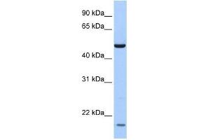 ZNF764 antibody used at 0. (ZNF764 Antikörper  (N-Term))