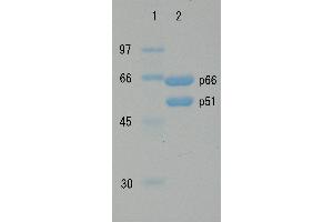 SDS-PAGE (SDS) image for HIV-1 Reverse Transcriptase (HIV1RT) (Active) protein (ABIN7233213) (HIV1RT Protein)