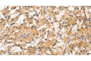 Immunohistochemistry (Paraffin-embedded Sections) (IHC (p)) image for anti-Signal Transducing Adaptor Molecule (SH3 Domain and ITAM Motif) 1 (STAM) antibody (ABIN7236033)