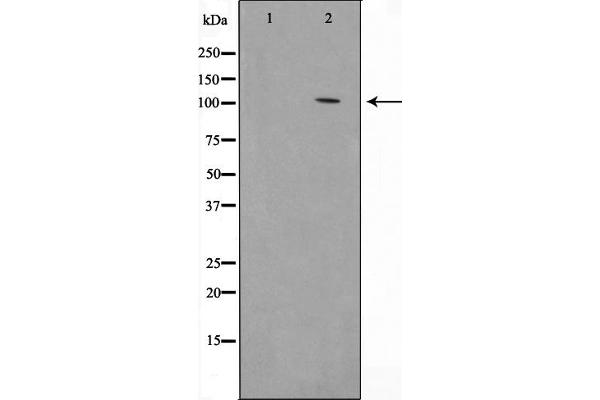 HSPH1 Antikörper  (C-Term)