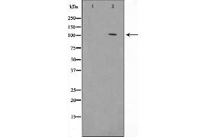 Western blot analysis on HeLa cell lysate using HSP105 Antibody,The lane on the left is treated with the antigen-specific peptide. (HSPH1 Antikörper  (C-Term))