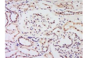 Formalin-fixed and paraffin embedded human kidney labeled with Anti-Bcl-2 Polyclonal Antibody, Unconjugated  at 1:200 followed by conjugation to the secondary antibody and DAB staining. (Bcl-2 Antikörper  (AA 51-150))