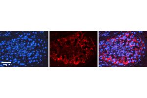 Rabbit Anti-RAD51 Antibody   Formalin Fixed Paraffin Embedded Tissue: Human Testis Tissue Observed Staining: Cytoplasm Primary Antibody Concentration: 1:100 Other Working Concentrations: N/A Secondary Antibody: Donkey anti-Rabbit-Cy3 Secondary Antibody Concentration: 1:200 Magnification: 20X Exposure Time: 0.