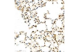 Immunohistochemistry of paraffin embedded mouse lung using HIF-3α (ABIN7074273) at dilution of 1:1600 (400x lens) (HIF3A Antikörper)