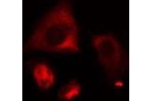 ABIN6274999 staining HeLa cells by IF/ICC. (CLN6 Antikörper  (Internal Region))