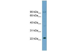 WB Suggested Anti-C15orf15 Antibody Titration: 0.