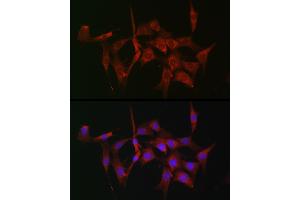 Immunofluorescence analysis of NIH-3T3 cells using [KO Validated] Fascin/Fascin/FSCN1 Rabbit pAb (ABIN3023681, ABIN3023682, ABIN3023683, ABIN1679910 and ABIN1679911) at dilution of 1:100 (40x lens). (Fascin Antikörper  (AA 394-493))