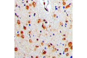 Immunohistochemical analysis of Beta-arrestin-1 staining in human brain formalin fixed paraffin embedded tissue section. (beta Arrestin 1 Antikörper  (C-Term))