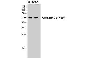 Western Blotting (WB) image for anti-CaMKIIalpha/delta (Lys542) antibody (ABIN3183638) (CaMKIIalpha/delta Antikörper  (Lys542))