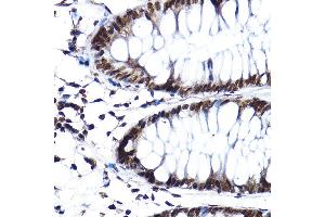 Immunohistochemistry (IHC) image for anti-Splicing Factor 3a, Subunit 3, 60kDa (SF3A3) (AA 292-501) antibody (ABIN1682671)