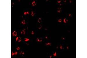 Immunofluorescence of PUMA in K562 cells with PUMA antibody at 10 ug/ml (PUMA Antikörper  (N-Term))