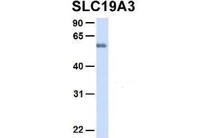 Western Blotting (WB) image for anti-Solute Carrier Family 19, Member 3 (Slc19a3) (Middle Region) antibody (ABIN2775519)