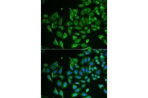 Immunofluorescence analysis of HeLa cell using CLEC3B antibody. (CLEC3B Antikörper)