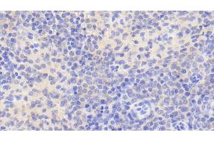 Immunohistochemistry (IHC) image for anti-Nuclear Receptor Subfamily 0, Group B, Member 2 (NR0B2) (AA 1-257) antibody (ABIN7440809)