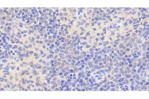 Detection of NR0B2 in Human Spleen Tissue using Polyclonal Antibody to Nuclear Receptor Subfamily 0,Group B,Member 2 (NR0B2) (NR0B2 Antikörper  (AA 1-257))