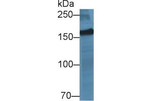 Detection of MYOM2 in Porcine Skeletal muscle lysate using Polyclonal Antibody to Myomesin 2 (MYOM2) (MYOM2 Antikörper  (AA 1130-1434))