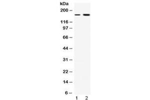 Western blot testing of 1) rat liver and 2) COLO320 lysate with CSB antibody at 0. (ERCC6 Antikörper  (AA 160-205))