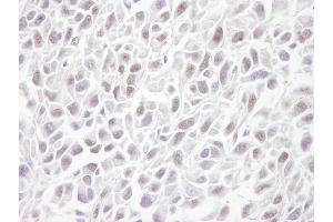 Immunohistochemistry (IHC) image for anti-Structural Maintenance of Chromosomes 3 (SMC3) (C-Term) antibody (ABIN7448804) (SMC3 Antikörper  (C-Term))