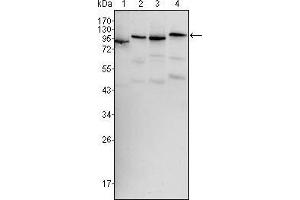Western blot analysis using BRAF mouse mAb against Hela (1), HL60 (2), HepG2 (3) and NIH/3T3 (4) cell lysate. (BRAF Antikörper)