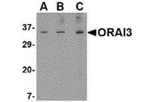 Western Blotting (WB) image for anti-ORAI Calcium Release-Activated Calcium Modulator 3 (ORAI3) (N-Term) antibody (ABIN2475965) (ORAI3 Antikörper  (N-Term))
