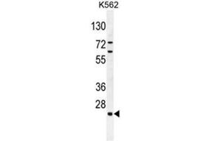 C15orf41 Antibody (Center) western blot analysis in K562 cell line lysates (35µg/lane). (BC052040 Antikörper  (Middle Region))