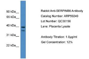 WB Suggested Anti-SERPINB6  Antibody Titration: 0. (SERPINB6 Antikörper  (Middle Region))