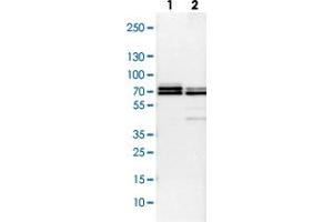 Western Blot (Cell lysate) analysis with TRAF6 polyclonal antibody  Lane 1: NIH-3T3 cell lysate (Mouse embryonic fibroblast cells) Lane 2: NBT-II cell lysate (Rat Wistar bladder tumour cells)
