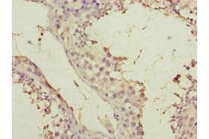 Immunohistochemistry of paraffin-embedded human testis tissue using ABIN7170586 at dilution of 1:100 (SPICE1 Antikörper  (AA 1-220))