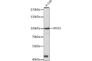 Western blot analysis of extracts of A-549 cells, using VPS51 antibody (ABIN7271280) at 1:1000 dilution. (VPS51 Antikörper  (AA 1-260))