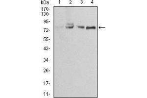 Western Blotting (WB) image for anti-Ezrin (EZR) (AA 292-464) antibody (ABIN5886560) (Ezrin Antikörper  (AA 292-464))