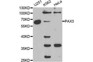 Western blot analysis of extracts of various cell lines, using PAX3 antibody. (Paired Box 3 Antikörper  (AA 1-206))