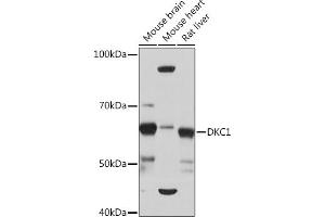 Western blot analysis of extracts of various cell lines, using DKC1 Rabbit mAb (ABIN7266869) at 1:1000 dilution. (DKC1 Antikörper)