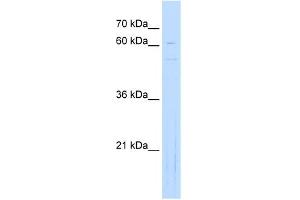 WB Suggested Anti-NOBOX Antibody Titration:  0. (NOBOX Antikörper  (Middle Region))