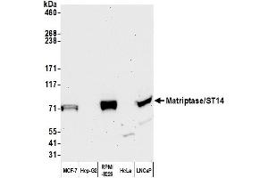 Western Blotting (WB) image for anti-Suppression of Tumorigenicity 14 (ST14) (C-Term) antibody (ABIN7450435)