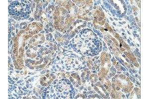 CRELD1 antibody was used for immunohistochemistry at a concentration of 4-8 ug/ml. (CRELD1 Antikörper  (C-Term))