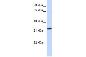 WB Suggested Anti-Nkx2-5 Antibody Titration: 0. (NK2 Homeobox 5 Antikörper  (N-Term))