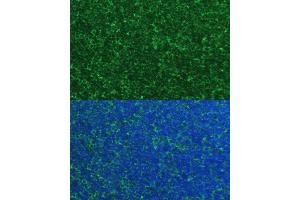Immunofluorescence (IF) image for anti-Phorbol-12-Myristate-13-Acetate-Induced Protein 1 (PMAIP1) (AA 1-54) antibody (ABIN6145810)