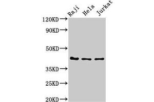 Western Blot Positive WB detected in: Raji whole cell lysate, Hela whole cell lysate, Jurkat whole cell lysate All lanes: Pregnancy-associated glycoprotein 1 antibody at 3 μg/mL Secondary Goat polyclonal to rabbit IgG at 1/50000 dilution Predicted band size: 43 kDa Observed band size: 43 kDa