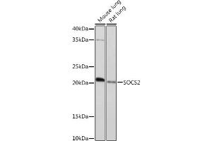Western blot analysis of extracts of various cell lines, using SOCS2 Rabbit mAb (ABIN7270641) at 1:1000 dilution. (SOCS2 Antikörper)