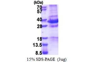SDS-PAGE (SDS) image for Melanoma Antigen Family D, 1 (MAGED1) (AA 504-760) protein (His tag) (ABIN6387343)